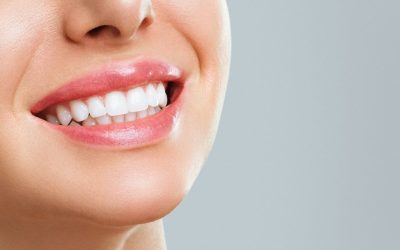 Sbiancamento dentale professionale: perché e come farlo?