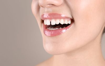 Diastema dentale: cause, trattamenti e opzioni correttive